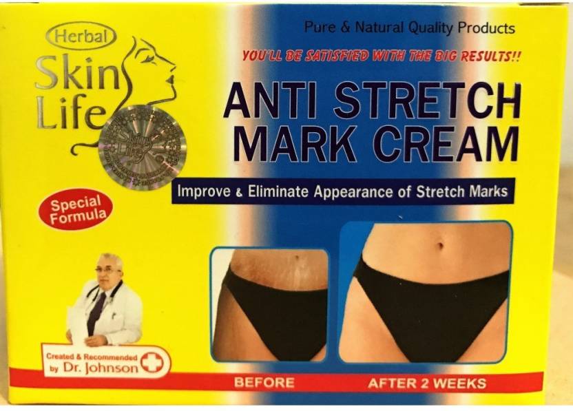 100-skin-life-anti-stretch-mark-cream-herbal-skin-life-cream-original-imaf7qb7h5xpsmzu.jpeg
