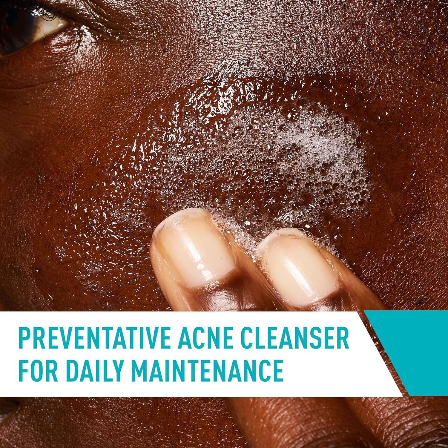 cerave-cleanser-default-title-cerave-acne-control-cleanser-237ml-43132028354799.jpg