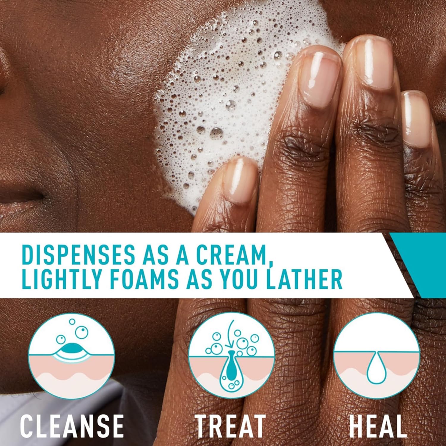 cerave-cleanser-default-title-cerave-acne-foaming-cream-cleanser-43132606677231.jpg