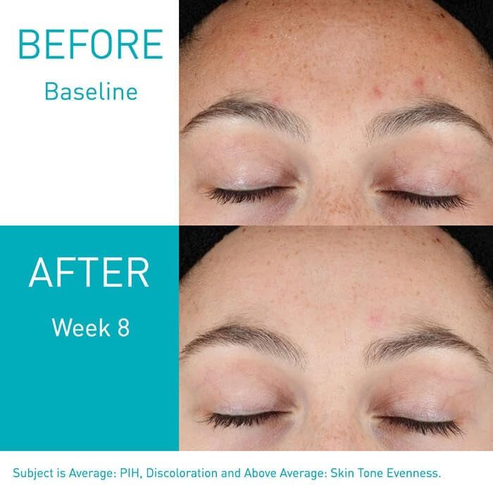cerave-serum-default-title-cerave-resurfacing-retinol-serum-41571072344303.jpg