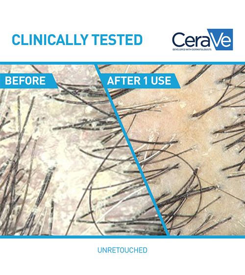 cerave-shampoo-default-title-cerave-gentle-hydrating-shampoo-43606556836079.jpg