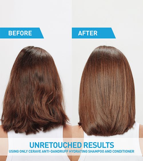 cerave-shampoo-default-title-cerave-gentle-hydrating-shampoo-43606556999919.jpg