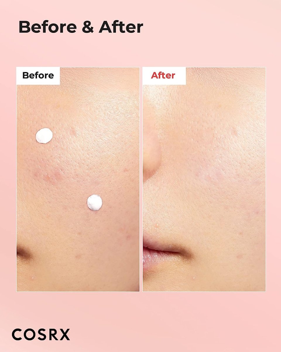 cosrx-lotion-default-title-cosrx-blemish-drying-lotion-30ml-40314883473647.jpg