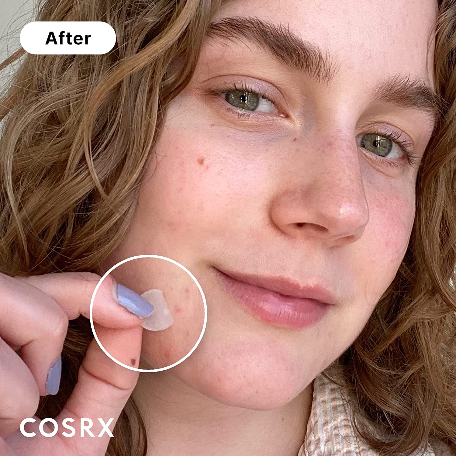 cosrx-pimple-patch-default-title-cosrx-acne-pimple-master-patch-2-sheet-39380319535343.jpg