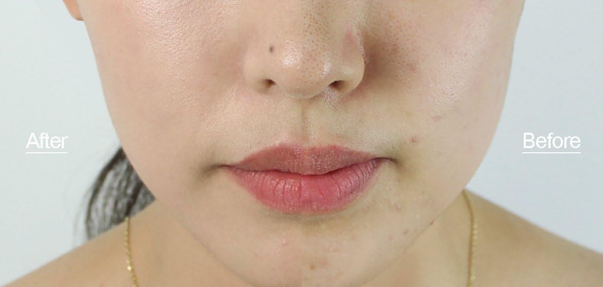 dear-klairs-cream-default-title-dear-klairs-illuminating-supple-blemish-cream-spf-40-pa-40ml-43022985724143.jpg