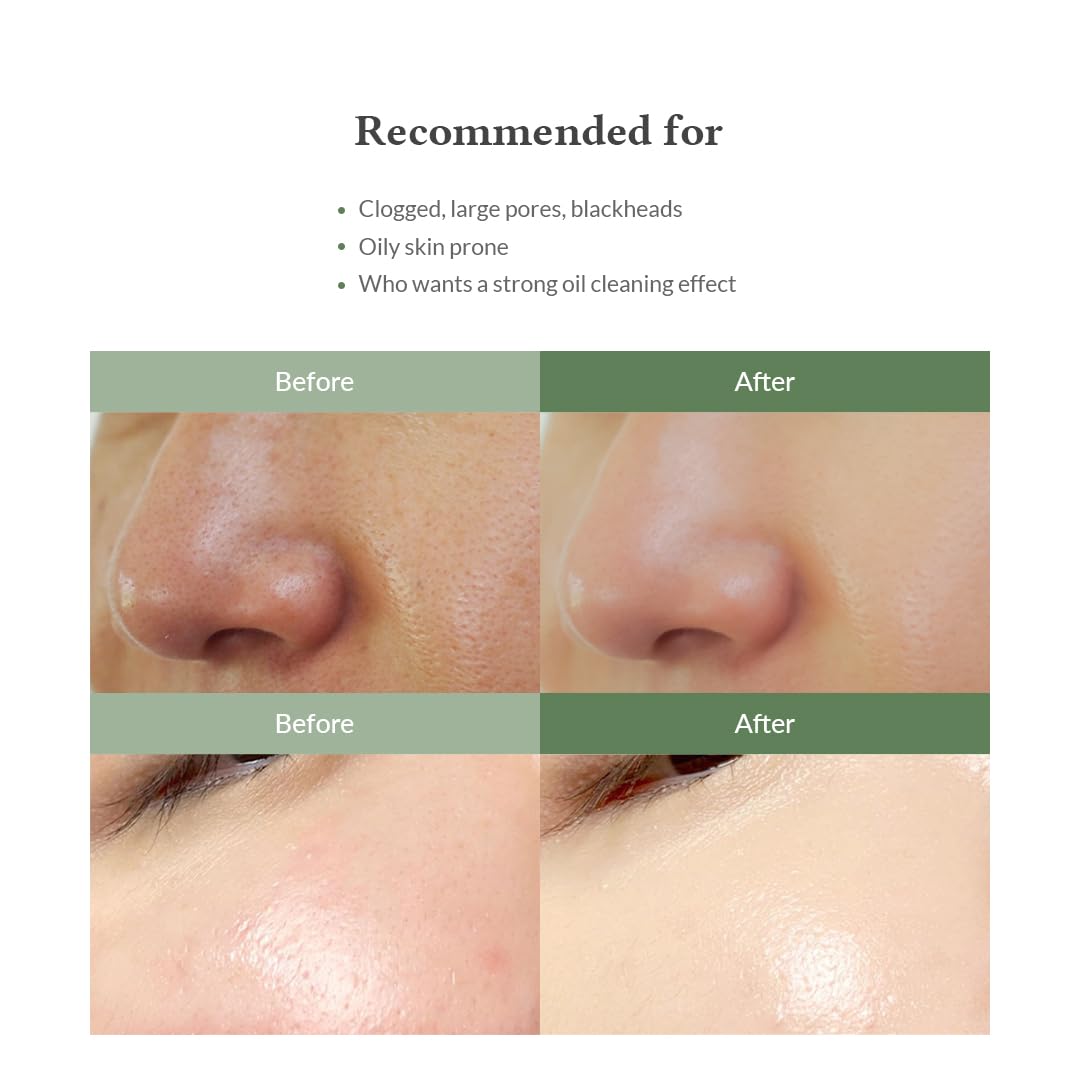 dr-althea-cleanser-default-title-dr-althea-premium-quick-step-sebum-cleanser-43105009991919.jpg