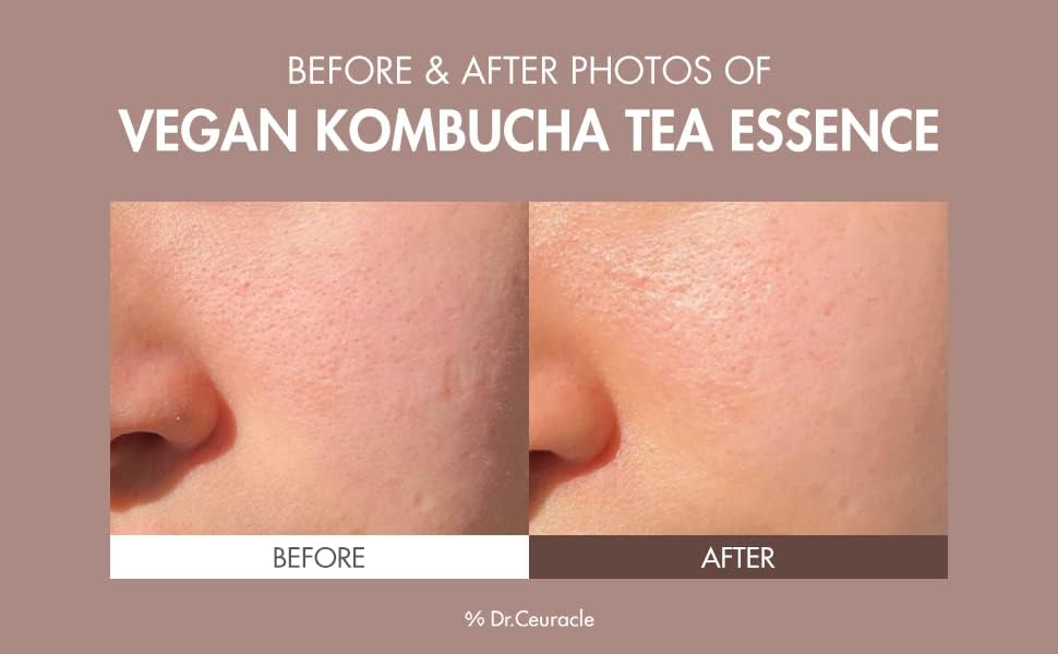 dr-cauracle-essence-default-title-dr-ceuracle-vegan-kombucha-tea-essence-150ml-39814766952687.jpg