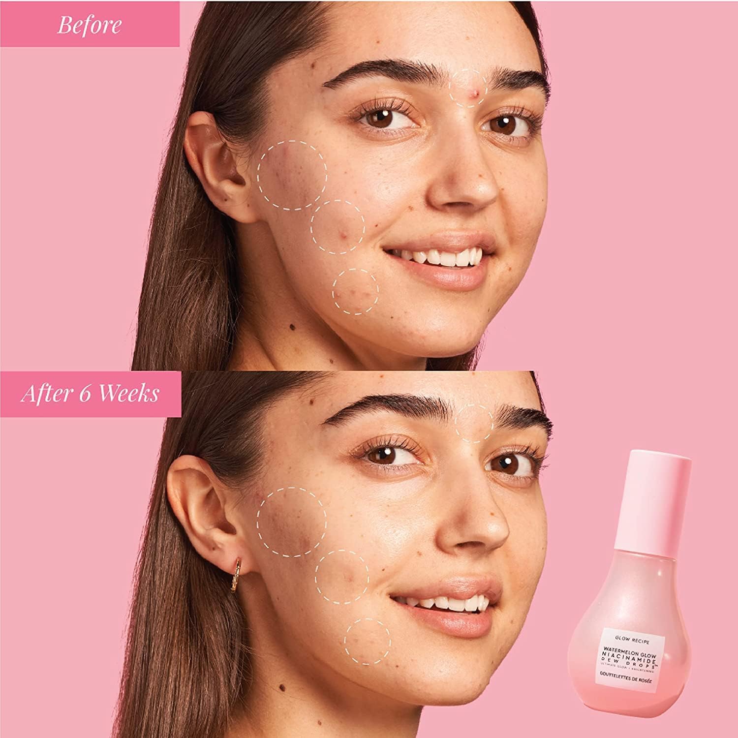 glow-recipe-serum-default-title-glow-recipe-watermelon-glow-niacinamide-43285791572207.jpg