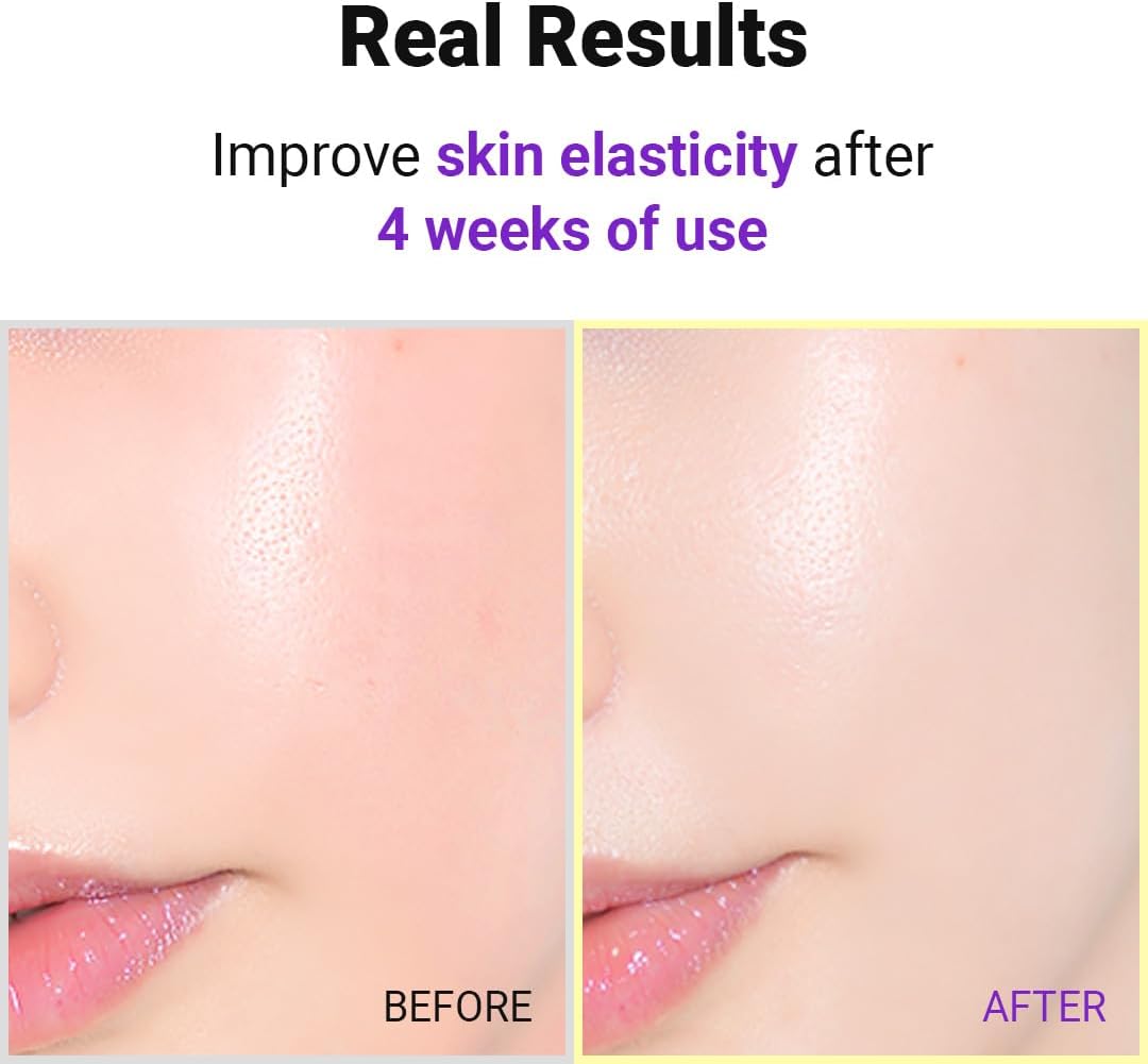 isntree-serum-default-title-isntree-hyper-retinol-ex-1-0-serum-41603297902831.jpg