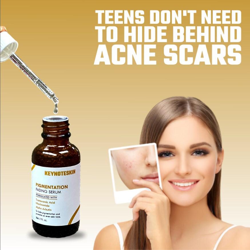 key-note-skin-serum-default-title-keynoteskin-pigmentation-fading-serum-30-ml-brightening-even-skin-tone-solution-43041060389103.jpg