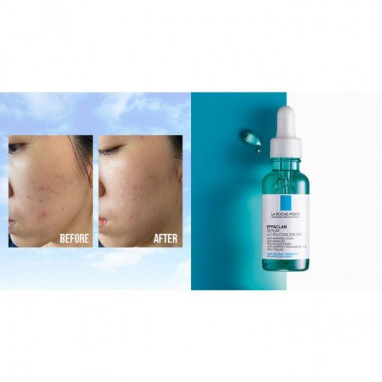 la-roche-posay-serum-default-title-la-roche-posay-effaclar-serum-ultra-concentrate-30ml-40255899402479.jpg