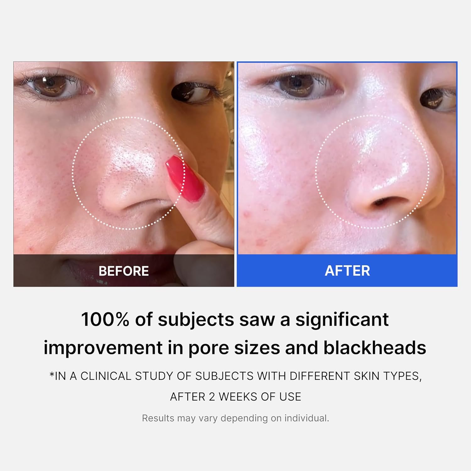 medicube-pore-pad-default-title-medicube-zero-pore-pad-155g-43737413943535.jpg