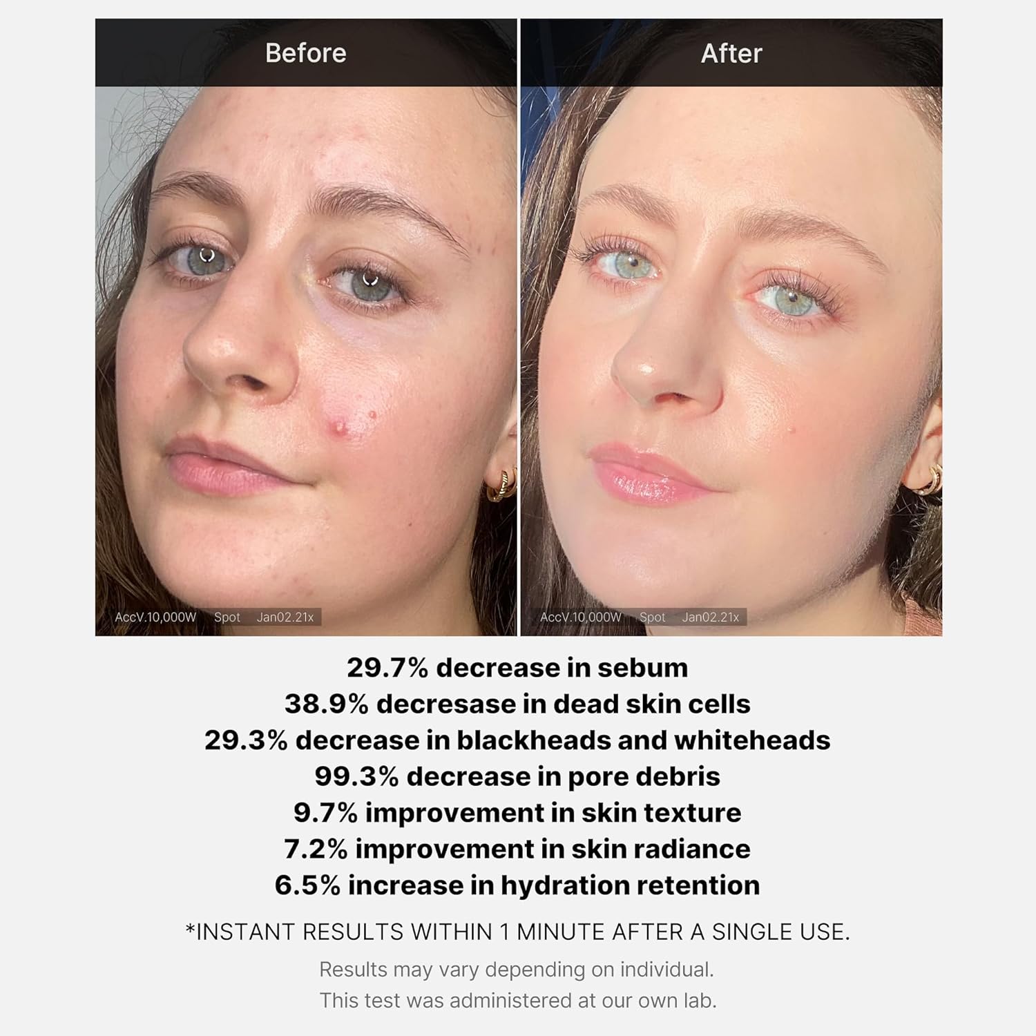 medicube-serum-default-title-medicube-red-acne-succinic-acid-peel-serum-43737393037551.jpg