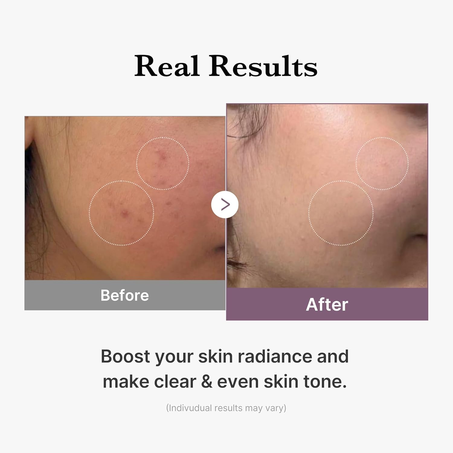 medicube-toner-default-title-medicube-age-r-glutathione-glow-milky-toner-43883524554991.jpg