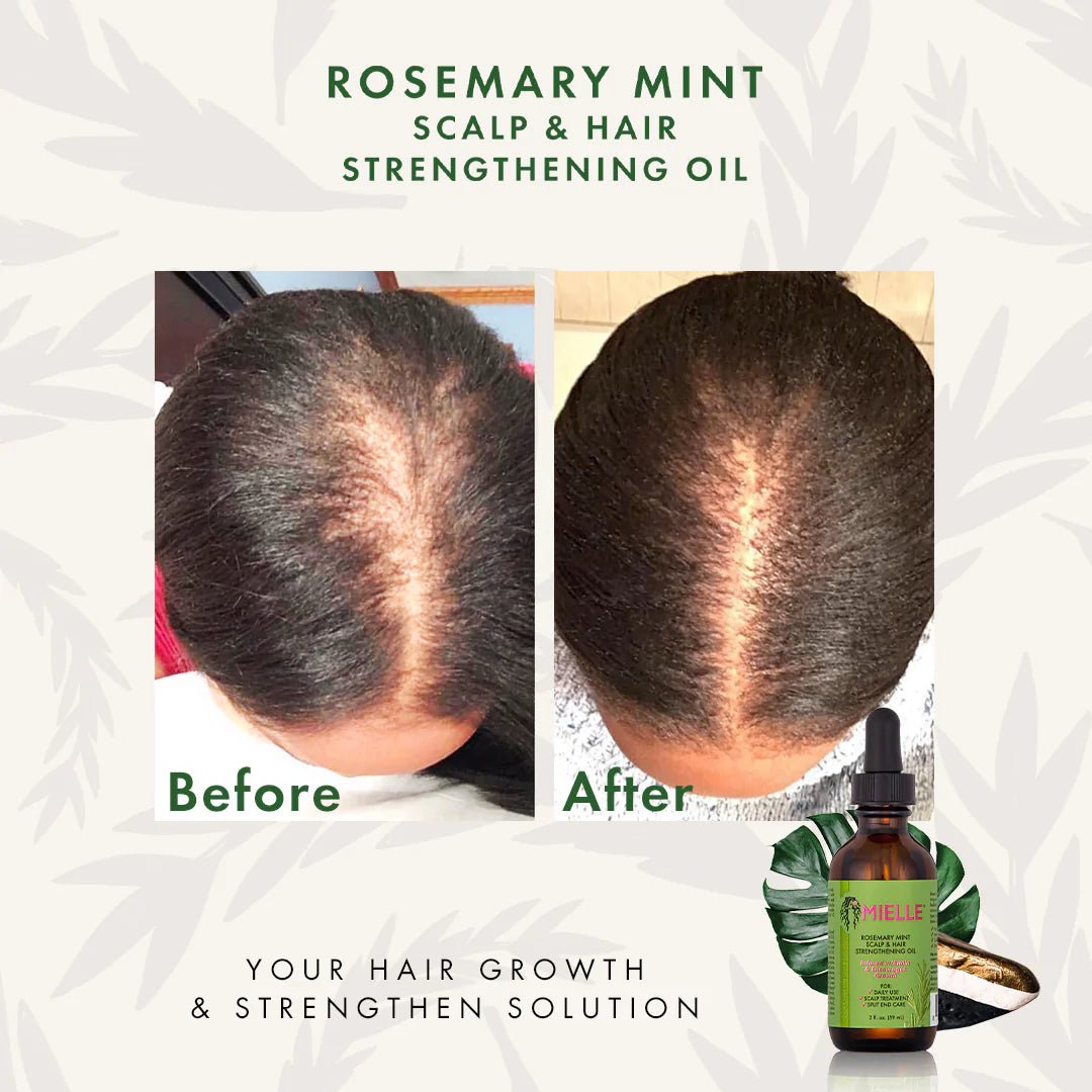 mielle-hair-oil-default-title-mielle-rosemary-mint-scalp-hair-strengthening-oil-59ml-40274219303151.jpg