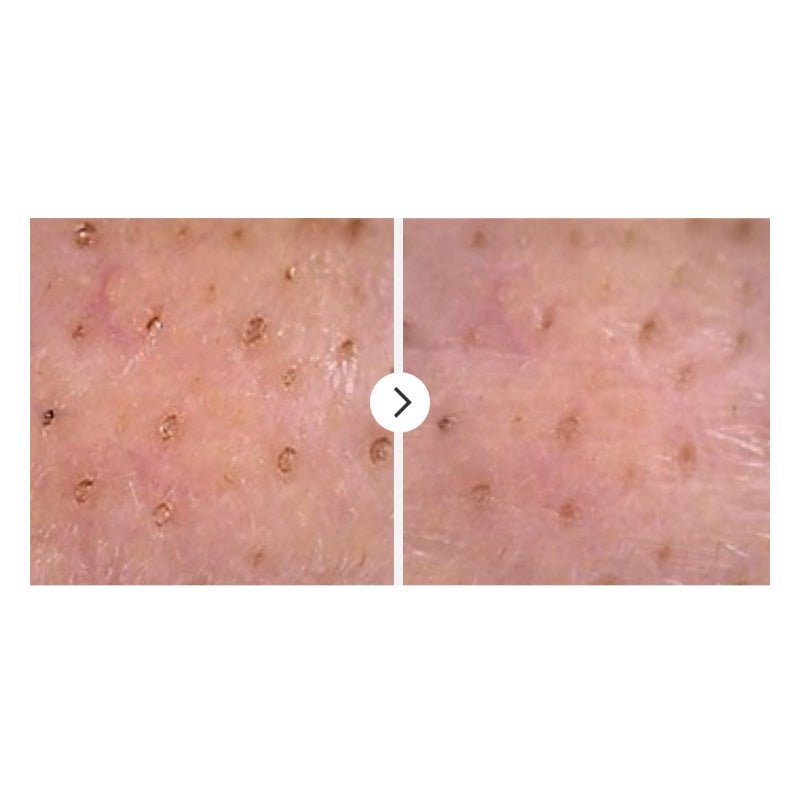 numbuzin-cleansing-oil-default-title-numbuzin-no-1-easy-peasy-cleansing-oil-40797672702191.jpg