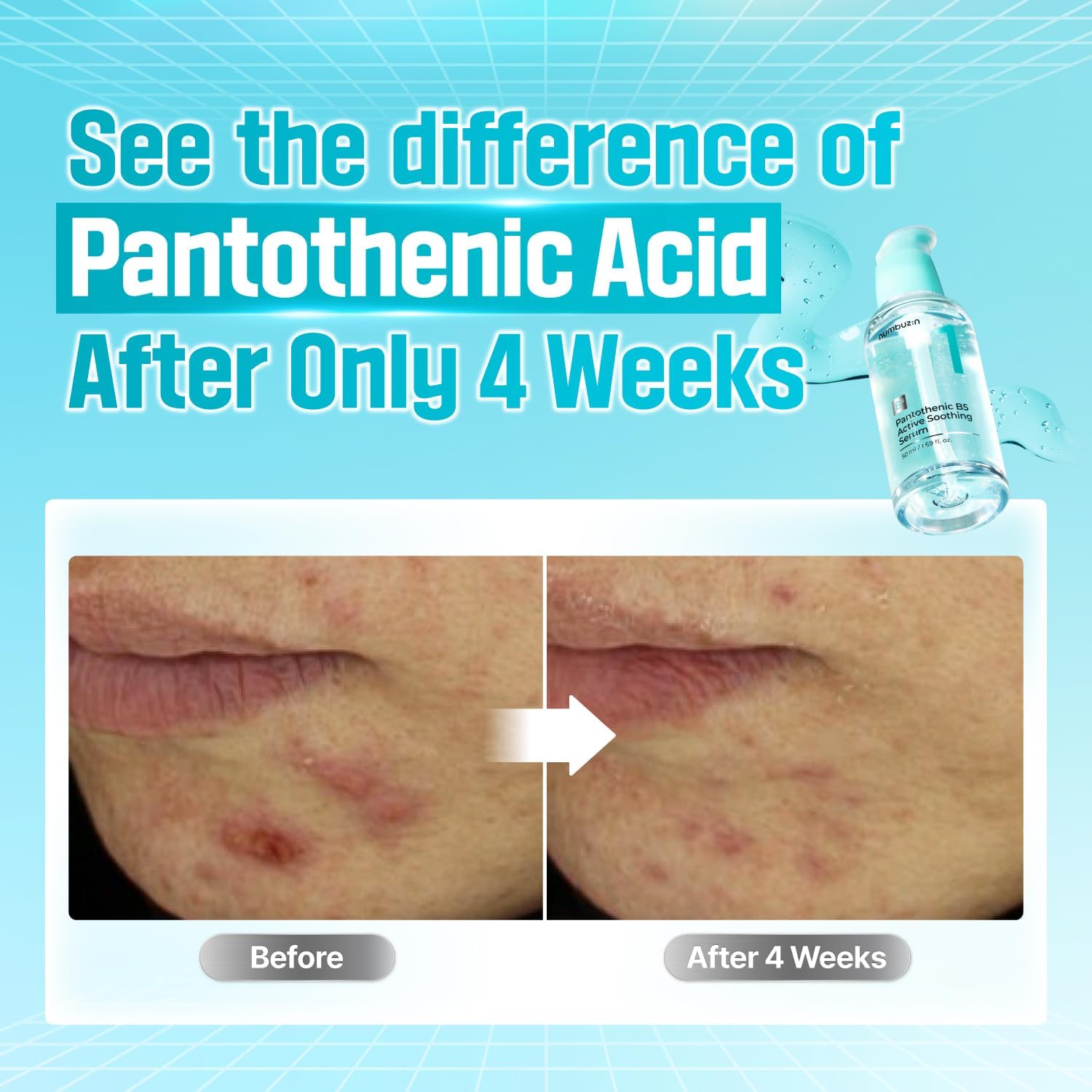 numbuzin-serum-default-title-numbuzin-no-1-pantothenic-b5-active-soothing-serum-50ml-42921358786799.jpg