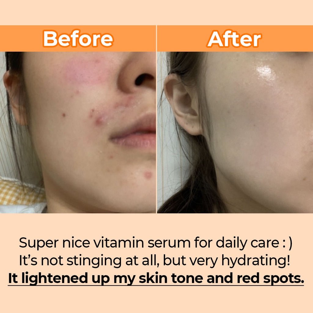numbuzin-serum-default-title-numbuzin-no-5-goodbye-blemish-serum-50ml-40791082828015.jpg