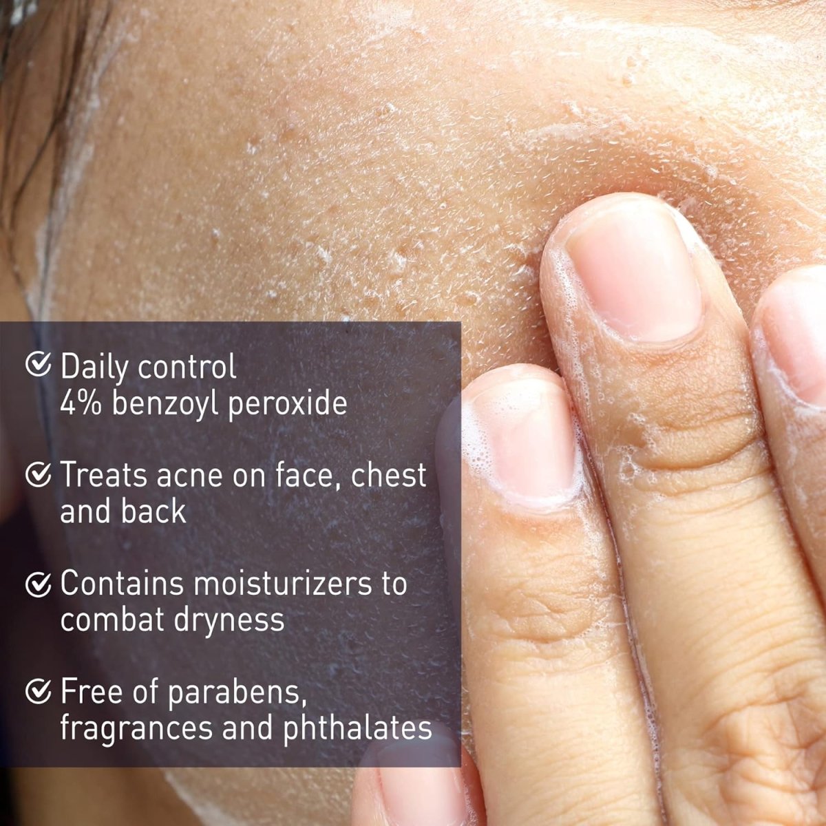 panoxyl-acne-cream-default-title-panoxyl-acne-creamy-wash-4-benzoyl-peroxide-daily-control-170g-40576361955567.jpg
