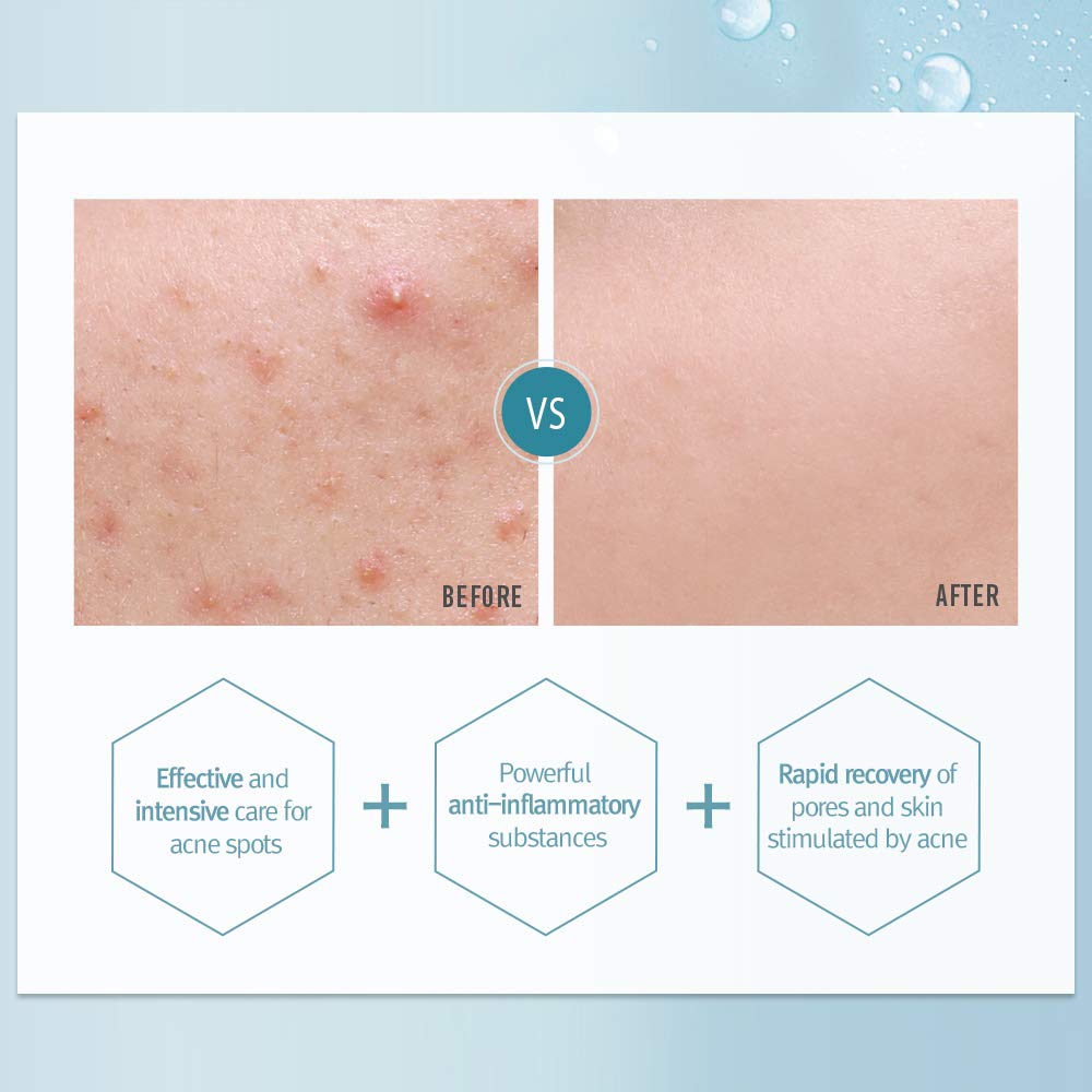 pyunkang-yul-eye-cream-default-title-pyunkang-yul-acne-spot-cream-15ml-39817353036015.jpg