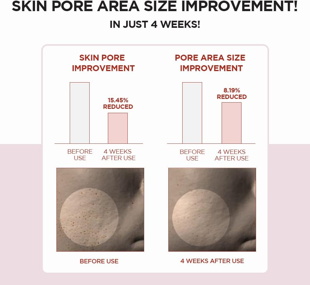 skin-1004-toner-default-title-skin1004-madagascar-centella-poremizing-clear-toner-41816823955695.jpg