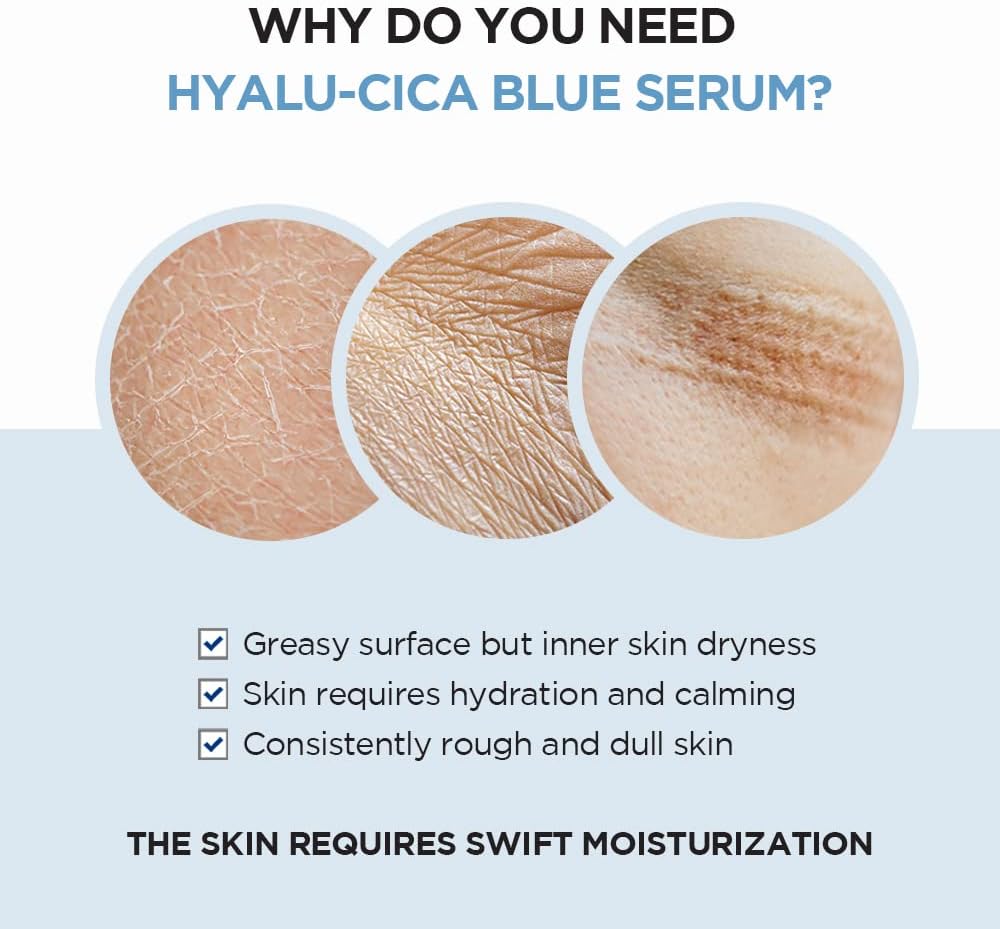 skin1004-serum-default-title-skin1004-madagascar-centella-hyalu-cica-blue-serum-41614948565231.jpg