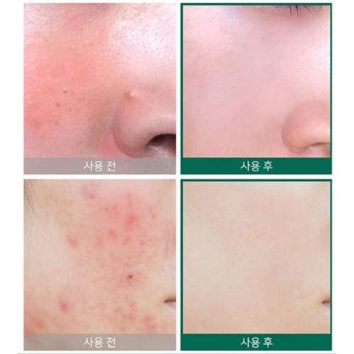 some-by-mi-health-beauty-default-title-some-by-mi-aha-pha-bha-30-days-miracle-toner-and-miracle-serum-set-39380376355055.jpg