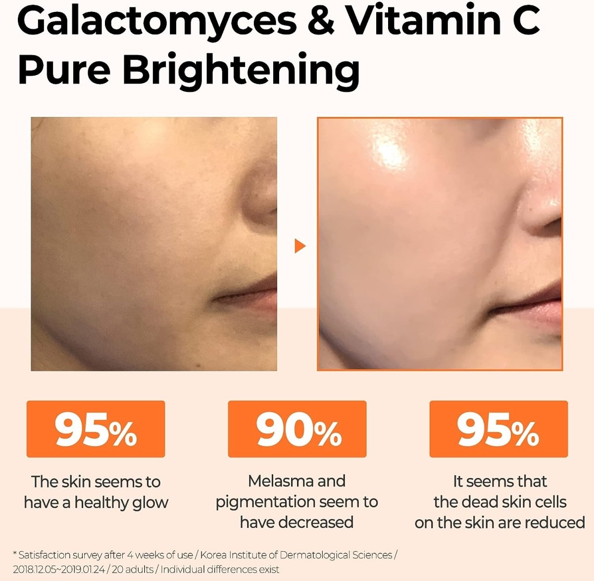 some-by-mi-health-beauty-default-title-somebymi-galactomyces-pure-vitamin-c-glow-serum-30ml-39949069287663.jpg