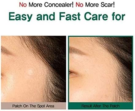 some-by-mi-patch-default-title-some-by-mi-clear-spot-patch-40209039065327.jpg