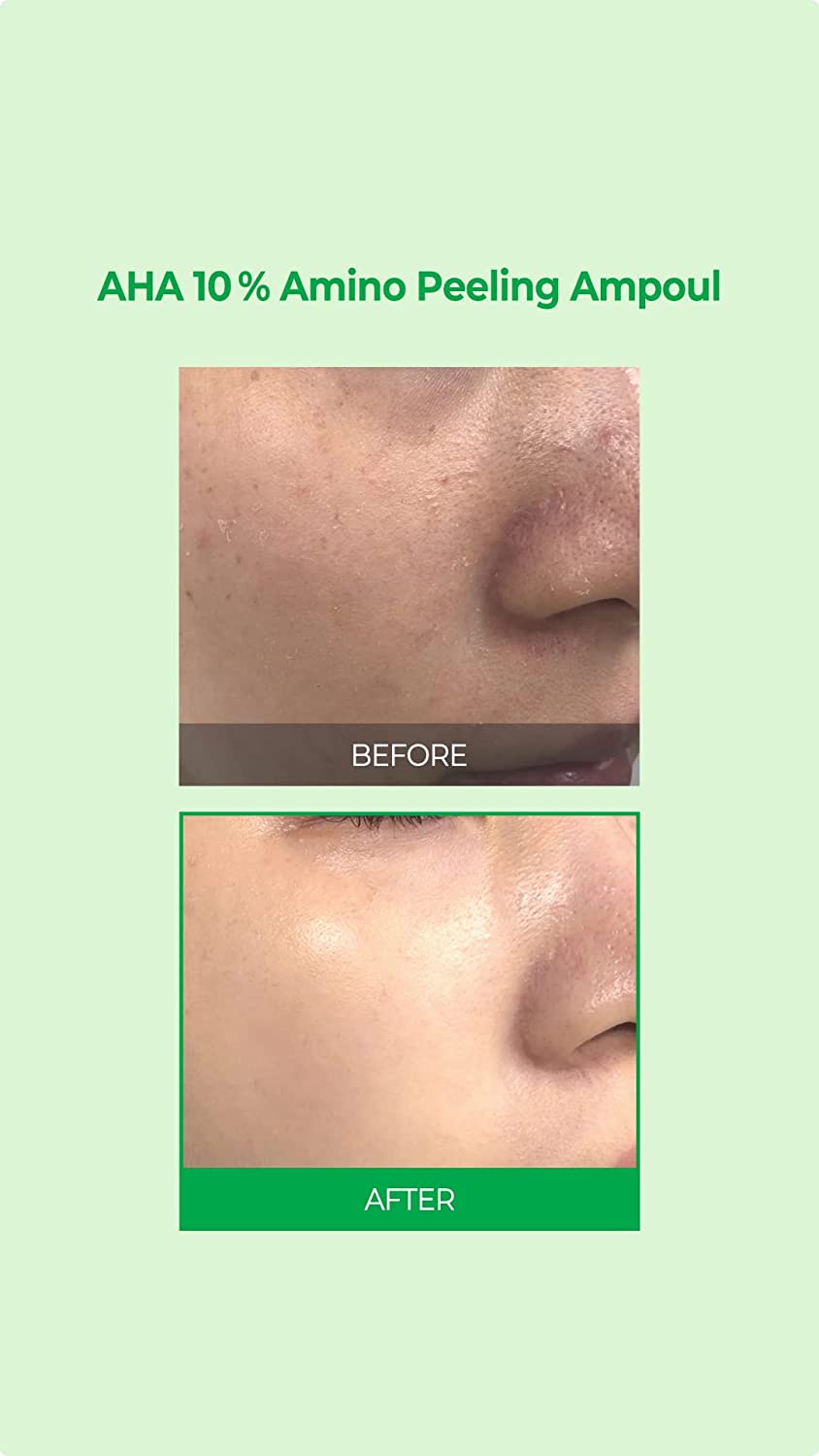 some-by-mi-serum-default-title-some-by-mi-aha-10-amino-peeling-ampoule-30ml-39694711881967.jpg
