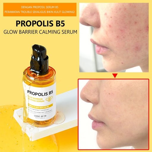 some-by-mi-serum-default-title-somebymi-propolis-calming-serum-50ml-39380383072495.jpg