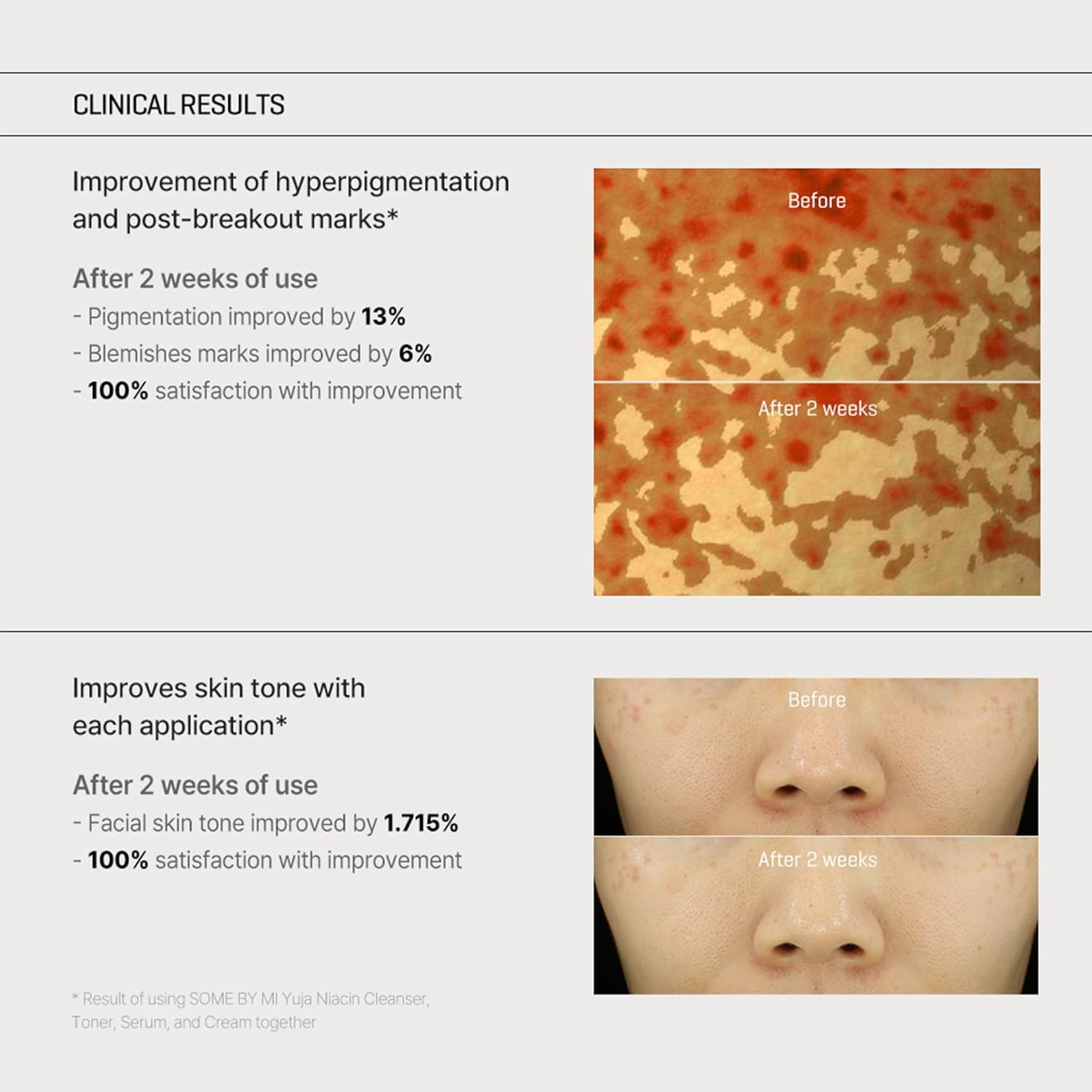 some-by-mi-skin-care-default-title-somebymi-yuja-niacin-brightening-anti-blemish-cream-43012240048367.jpg