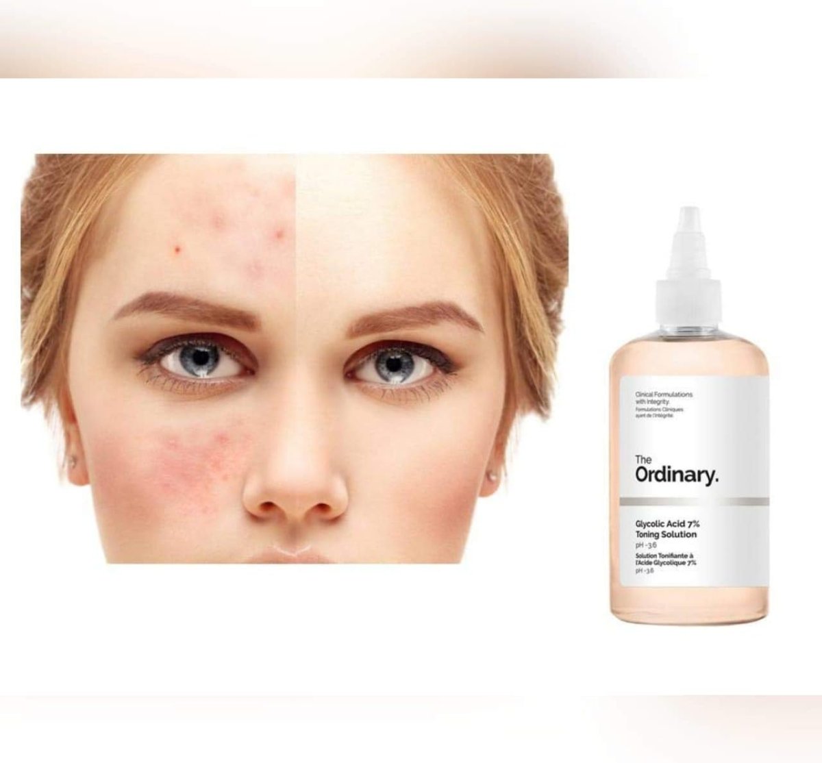 the-ordinary-default-title-the-ordinary-glycolic-acid-7-toning-solution-41960676917487.jpg